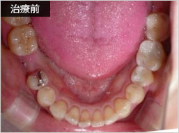 治療前