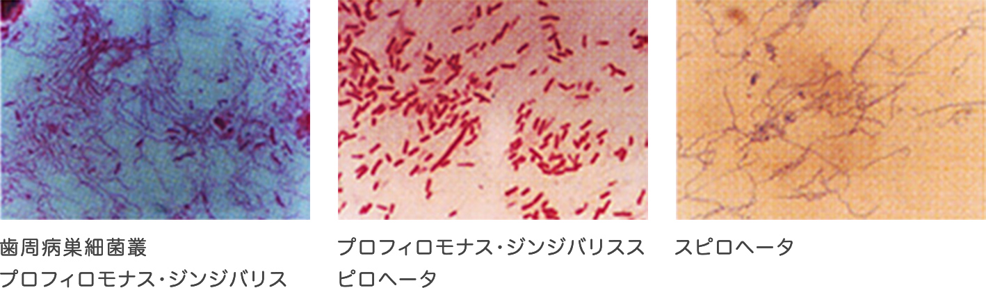 図1-1 歯周病原菌