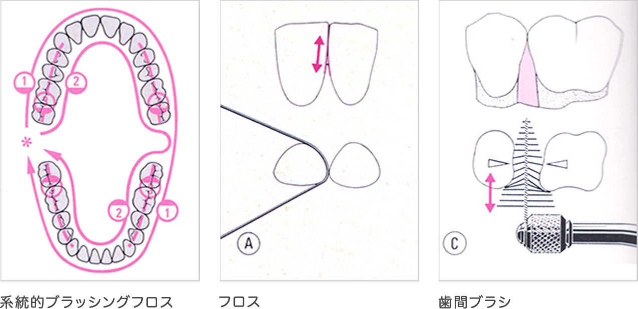 歯磨き