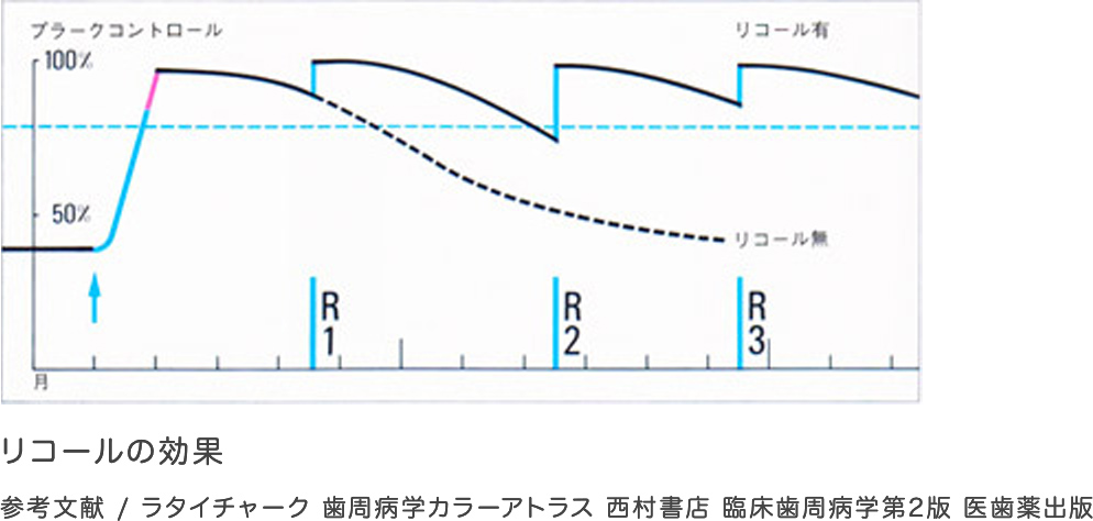 リコールの重要性