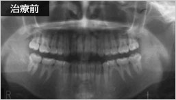 治療前