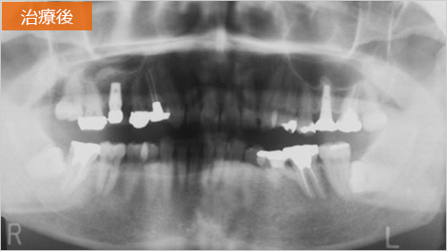 治療後