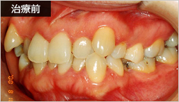 治療前