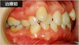 治療前