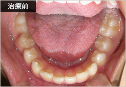 治療前
